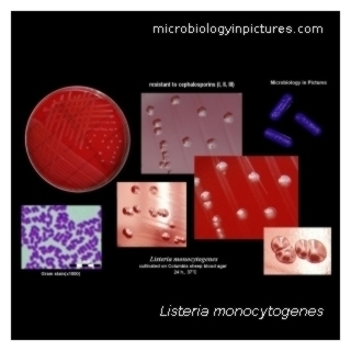 listeria